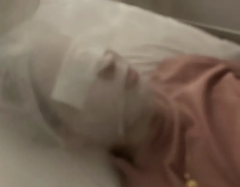 Paciente deitada recebendo vapor no rosto durante a limpeza de pele